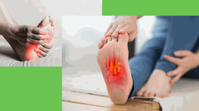 plantar fasciitis