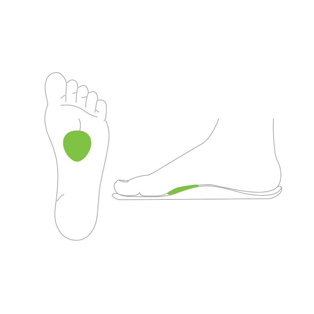 Metatarsal Domes