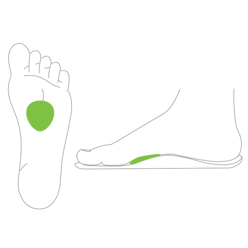 Metatarsal Domes